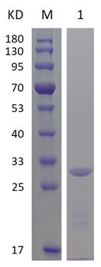15% SDS-PAGE analysis profiles of purified FimH (CBB stained).